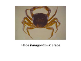 HI de Paragonimus: crabe
 
