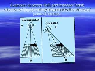 Distortion | PPT