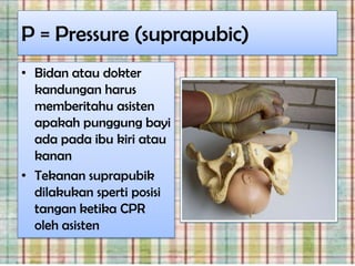 P = Pressure (suprapubic)
• Bidan atau dokter
  kandungan harus
  memberitahu asisten
  apakah punggung bayi
  ada pada ibu kiri atau
  kanan
• Tekanan suprapubik
  dilakukan sperti posisi
  tangan ketika CPR
  oleh asisten
 