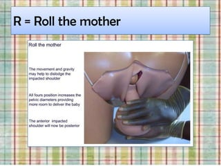 R = Roll the mother
 