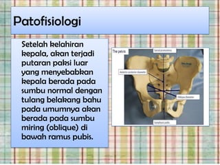 Patofisiologi
 Setelah kelahiran
 kepala, akan terjadi
 putaran paksi luar
 yang menyebabkan
 kepala berada pada
 sumbu normal dengan
 tulang belakang bahu
 pada umumnya akan
 berada pada sumbu
 miring (oblique) di
 bawah ramus pubis.
 