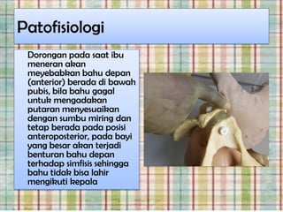 Patofisiologi
 Dorongan pada saat ibu
 meneran akan
 meyebabkan bahu depan
 (anterior) berada di bawah
 pubis, bila bahu gagal
 untuk mengadakan
 putaran menyesuaikan
 dengan sumbu miring dan
 tetap berada pada posisi
 anteroposterior, pada bayi
 yang besar akan terjadi
 benturan bahu depan
 terhadap simfisis sehingga
 bahu tidak bisa lahir
 mengikuti kepala
 
