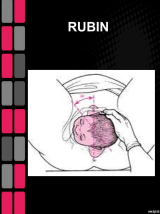 RUBIN
 