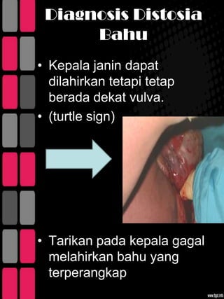 Diagnosis Distosia
      Bahu
• Kepala janin dapat
  dilahirkan tetapi tetap
  berada dekat vulva.
• (turtle sign)




• Tarikan pada kepala gagal
  melahirkan bahu yang
  terperangkap
 