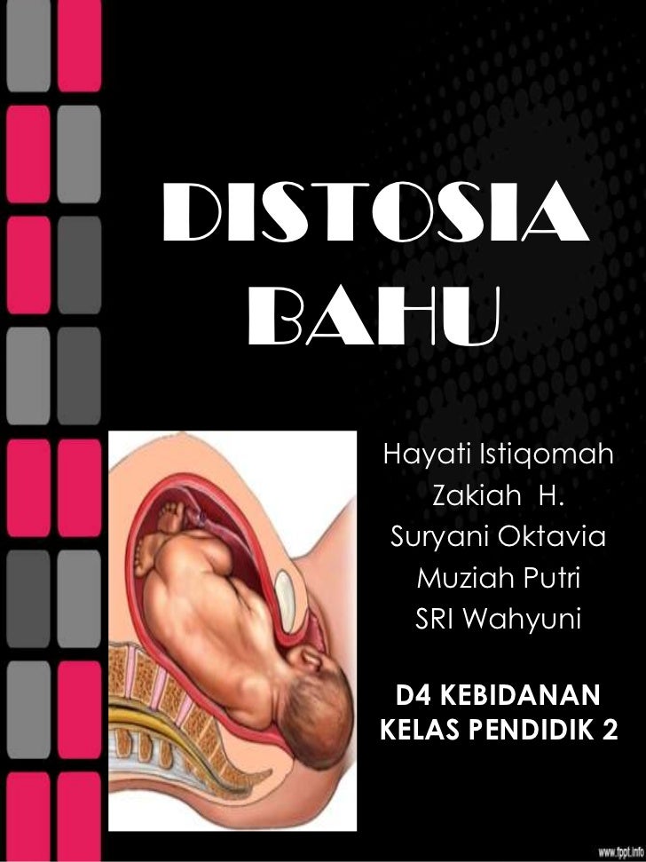 Makalah asuhan kebidanan Distosia