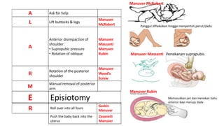 A Ask for help
L Lift buttocks & legs
Manuver
McRobert
A
Anterior disimpaction of
shoulder:
• Suprapubic pressure
• Rotation of oblique
Manuver
Massanti
Manuver
Rubin
R
Rotation of the posterior
shoulder
Manuver
Wood’s
Screw
M
Manual removal of posterior
arm
Manuver Massanti
Manuver McRobert
Manuver Rubin
Memasukkan jari dan menekan bahu
anterior bayi menuju dada
Penekanan suprapubis
Panggul difleksikan hingga menyentuh perut/dada
E Episiotomy
R Roll over into all fours
Gaskin
Manuver
Push the baby back into the
uterus
Zavanelli
Manuver
 