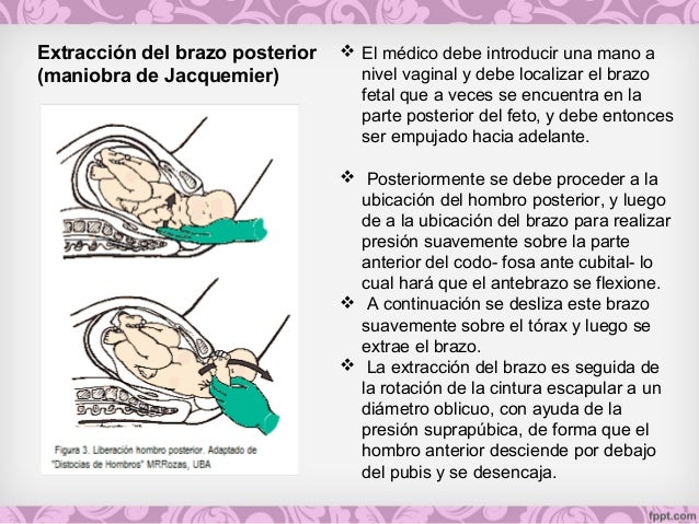 Signo De Jacquemier Chadwick Johnson www.slideshare.net