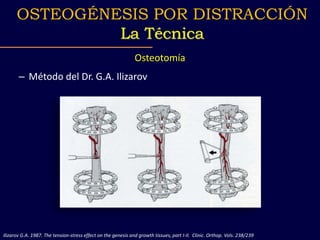 Osteotomía
– Método del Dr. G.A. Ilizarov
Ilizarov G.A. 1987. The tension-stress effect on the genesis and growth tissues, part I-II. Clinic. Orthop. Vols. 238/239
OSTEOGÉNESIS POR DISTRACCIÓN
La Técnica
 