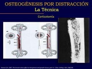 Corticotomía
Ilizarov G.A. 1987. The tension-stress effect on the genesis and growth tissues, part I-II. Clinic. Orthop. Vols. 238/239
OSTEOGÉNESIS POR DISTRACCIÓN
La Técnica
 