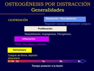 CICATRIZACIÓN
Tiempo posterior a la lesión
Hemostasis
Inflamación
Proliferación
Resolución / Remodelación
PMNs, Macrófagos, Linfocitos
Reepitelización, Angiogénesis, Fibrogénesis,
Regresión vascular, remodelación colágena
Coágulo de fibrina, depósito
plaquetario
1d 3d 1s 6s 8s
OSTEOGÉNESIS POR DISTRACCIÓN
Generalidades
 