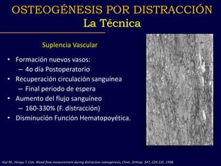 Suplencia Vascular
• Formación nuevos vasos:
– 4o día Postoperatorio
• Recuperación circulación sanguínea
– Final periodo de espera
• Aumento del flujo sanguíneo
– 160-330% (F. distracción)
• Disminución Función Hematopoyética.
OSTEOGÉNESIS POR DISTRACCIÓN
La Técnica
Koji M., Hiroyu T. Cols. Blood flow measurement during distraction osteogenesis, Clinic. Orthop. 347, 229-235. 1998.
 
