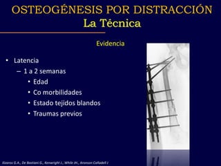 Evidencia
• Latencia
– 1 a 2 semanas
• Edad
• Co morbilidades
• Estado tejidos blandos
• Traumas previos
Ilizarov G.A., De Bastiani G., Kenwright J., While JH., Aronson Cañadell J
OSTEOGÉNESIS POR DISTRACCIÓN
La Técnica
 