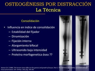 Consolidación
• Influencia en índice de consolidación
– Estabilidad del fijador
– Dinamización
– Fijación interna
– Alargamiento bifocal
– Ultrasonido baja intensidad
– Proteína morfogenetica ósea ??
Ilizarov G.A. (1989). The tension-stress effect on the genesis and growth of tissues: Part 1. The influence and stability of fixation and soft
tissue preservation. Clin. Orthop. 238, pag. 249-281
OSTEOGÉNESIS POR DISTRACCIÓN
La Técnica
 