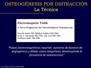 “Pulsos electromagnéticos reportan aumento de factores de
angiogénesis y dilatar vasos sanguíneos; disminuyendo la
frecuencia de osteonecrosis”
OSTEOGÉNESIS POR DISTRACCIÓN
La Técnica
Clin. Orthops. Relat. Res. March 2008.
 
