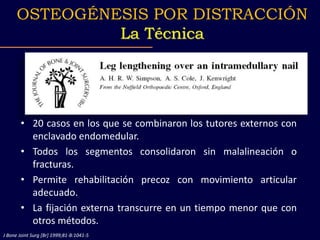 • 20 casos en los que se combinaron los tutores externos con
enclavado endomedular.
• Todos los segmentos consolidaron sin malalineación o
fracturas.
• Permite rehabilitación precoz con movimiento articular
adecuado.
• La fijación externa transcurre en un tiempo menor que con
otros métodos.
OSTEOGÉNESIS POR DISTRACCIÓN
La Técnica
J Bone Joint Surg [Br] 1999;81-B:1041-5
 