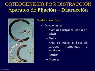 • Componentes:
– Alambres delgados (con o sin
oliva)
– Pines
– Aros de metal o fibra de
carbono (completos o
semiaros)
– Rótulas
– Motores
www.ota.org
Fijadores circulares
OSTEOGÉNESIS POR DISTRACCIÓN
Aparatos de Fijación – Distracción
 