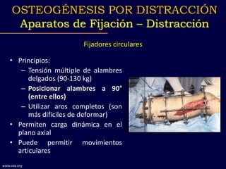 Fijadores circulares
• Principios:
– Tensión múltiple de alambres
delgados (90-130 kg)
– Posicionar alambres a 90°
(entre ellos)
– Utilizar aros completos (son
más dificiles de deformar)
• Permiten carga dinámica en el
plano axial
• Puede permitir movimientos
articulares
OSTEOGÉNESIS POR DISTRACCIÓN
Aparatos de Fijación – Distracción
www.ota.org
 