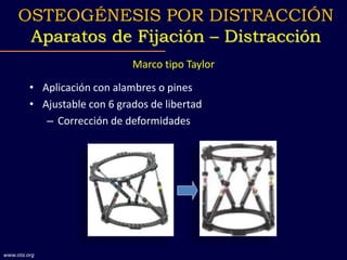 Marco tipo Taylor
• Aplicación con alambres o pines
• Ajustable con 6 grados de libertad
– Corrección de deformidades
OSTEOGÉNESIS POR DISTRACCIÓN
Aparatos de Fijación – Distracción
www.ota.org
 
