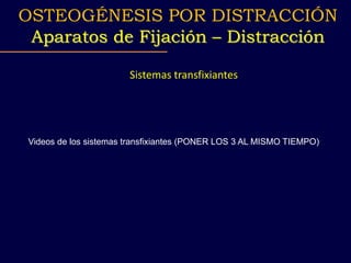 OSTEOGÉNESIS POR DISTRACCIÓN
Aparatos de Fijación – Distracción
Sistemas transfixiantes
Videos de los sistemas transfixiantes (PONER LOS 3 AL MISMO TIEMPO)
 