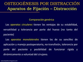 Comparación genérica
Los aparatos circulares tienen las ventajas de su estabilidad,
versatilidad y tolerancia por parte del hueso (no tanto del
paciente)
Los aparatos monolaterales tienen las de su sencillez de
aplicación y manejo postoperatorio, no-transfixión, tolerancia por
parte del paciente y posibilidad de funcionar rígida y
dinámicamente a voluntad del cirujano.
OSTEOGÉNESIS POR DISTRACCIÓN
Aparatos de Fijación – Distracción
www.depablos-bruguera.com
 