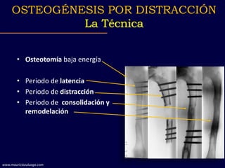 • Osteotomía baja energía
• Periodo de latencia
• Periodo de distracción
• Periodo de consolidación y
remodelación
OSTEOGÉ...