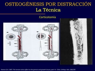 Corticotomía
Ilizarov G.A. 1987. The tension-stress effect on the genesis and growth tissues, part I-II. Clinic. Orthop. V...