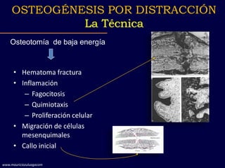 • Hematoma fractura
• Inflamación
– Fagocitosis
– Quimiotaxis
– Proliferación celular
• Migración de células
mesenquimales...