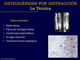 Zona esclerótica
• Radio densa
• Fibras de cartílago hialino
• Condrocitos hipertróficos
• Arreglo columnar
• Formación hu...