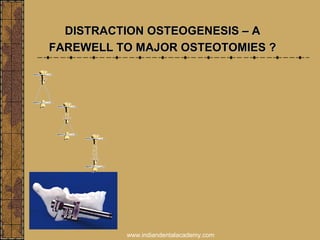 DISTRACTION OSTEOGENESIS – ADISTRACTION OSTEOGENESIS – A
FAREWELL TO MAJOR OSTEOTOMIES ?FAREWELL TO MAJOR OSTEOTOMIES ?
www.indiandentalacademy.com
 