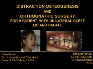 DR.SABA BASIT
MCPS RESIDENT
ORTHODONTICS
AFID
Case Report
By: Ji Hyun Kim and Coworkers
From: AJO-DO March 2015
 