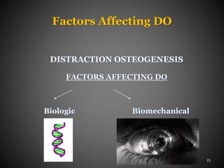 Factors Affecting DO
25
DISTRACTION OSTEOGENESIS
FACTORS AFFECTING DO
Biologic Biomechanical
 
