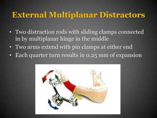 External Multiplanar Distractors
• Two distraction rods with sliding clamps connected
in by multiplanar hinge in the middle
• Two arms extend with pin clamps at either end
• Each quarter turn results in 0.25 mm of expansion
 