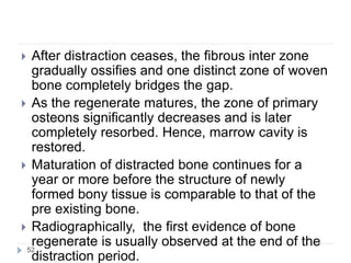 Distraction osteogenesis of craniofacial region | PPTX