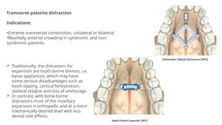 Transverse palatine distraction
Indications:
•Extreme transversal constriction, unilateral or bilateral
•Maxillally anterior crowding in syndromic and non-
syndromic patients.
 Traditionally, the distractors for
expansion are tooth-borne devices, i.e.
hyrax appliances, which may have
some serious disadvantages such as
tooth tipping, cortical fenestration,
skeletal relapse and loss of anchorage.
 In contrast, with bone-borne
distractors most of the maxillary
expansion is orthopedic and at a more
mechanically desired level with less
dental side effects.
 