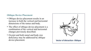 Oblique Device Placement
• Oblique device placement results in an
increase in both the vertical and horizontal
dimensions of the ramus and body.
• The effect of oblique device placement is a
combination of the vertical and horizontal
changes previously described.
• Overjet and both ramal and body size
deficiency may be addressed by oblique
device placement.
 