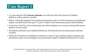 • A 5-year-old girl with Crouzon syndrome was referred to the clinic because of midface
deficiency and an anterior crossbite.
• Before visiting the hospital, fronto-orbital advancement with Le Fort III osteotomy and strabismus
surgery was performed at the age of 4 years to improve her intracranial pressure and exorbitism.
• At the time of the first visit to the hospital, the chief complaint was a concave facial profile and an
anterior reverse overjet.
• The patient exhibited severe midfacial deficiency with skeletal Class III malocclusion and total
crossbite.
• During the first phase of orthodontic treatment at 5 years of age, maxillary lateral expansion and
protraction using a reverse headgear were performed to improve midfacial deficiency for 4 years.
Sayuri Yamamotoet al. Long-term follow-up of a patient diagnosed with Crouzon syndrome who underwent Le Fort I and III
distraction osteogenesis using a rigid external distractor system. Angle Orthod.
Case Report 1
 