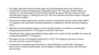 • The upper right lateral incisor and the upper left second premolar tooth were found to be
congenitally missing in the panoramic radiograph (Figure 1D). The upper dental midline was
deviated 2.3 mm toward the left from the facial midline because of the cant of the maxillary
occlusal plane (Figures 1A through D and 7A). The lower skeletal and dental midlines coincided
with the facial midline.
• Furthermore, lateral cephalometric analysis showed a skeletal Class III jaw relationship (ANB 5
21.4 degrees) with horizontal maxillary hypoplasia in comparison with the normative Japanese
mean.
• Maxillary anterior-posterior length was short, and the maxilla was located in a significantly
retrognathic position (SNA 5 72.0 degrees, A-Ptm/PP 5 43.0 mm.
• Mandibular body length and mandibular plane angle were normal, but the mandible was relatively
retropositioned (SNB 5 73.4 degrees).
• The upper incisors were lingually inclined (U1 to FH 5 101.8 degrees); the lower incisors,
however, showed a normal inclination.
• Examination of nasopharyngeal function by a speech therapist revealed risks of language
deterioration, moderate hypernasality, and incomplete velopharyngeal closure after maxillary
advancement.
 