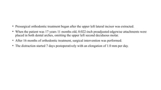 • Presurgical orthodontic treatment began after the upper left lateral incisor was extracted.
• When the patient was 17 years 11 months old, 0.022-inch preadjusted edgewise attachments were
placed in both dental arches, omitting the upper left second deciduous molar.
• After 16 months of orthodontic treatment, surgical intervention was performed.
• The distraction started 7 days postoperatively with an elongation of 1.0 mm per day.
 