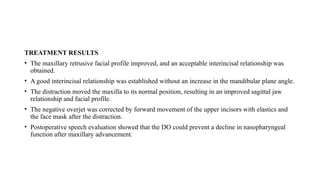 TREATMENT RESULTS
• The maxillary retrusive facial profile improved, and an acceptable interincisal relationship was
obtained.
• A good interincisal relationship was established without an increase in the mandibular plane angle.
• The distraction moved the maxilla to its normal position, resulting in an improved sagittal jaw
relationship and facial profile.
• The negative overjet was corrected by forward movement of the upper incisors with elastics and
the face mask after the distraction.
• Postoperative speech evaluation showed that the DO could prevent a decline in nasopharyngeal
function after maxillary advancement.
 
