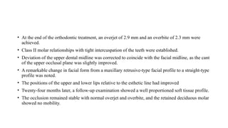 • At the end of the orthodontic treatment, an overjet of 2.9 mm and an overbite of 2.3 mm were
achieved.
• Class II molar relationships with tight intercuspation of the teeth were established.
• Deviation of the upper dental midline was corrected to coincide with the facial midline, as the cant
of the upper occlusal plane was slightly improved.
• A remarkable change in facial form from a maxillary retrusive-type facial profile to a straight-type
profile was noted.
• The positions of the upper and lower lips relative to the esthetic line had improved
• Twenty-four months later, a follow-up examination showed a well proportioned soft tissue profile.
• The occlusion remained stable with normal overjet and overbite, and the retained deciduous molar
showed no mobility.
 