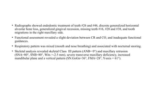 • Radiographs showed endodontic treatment of teeth #26 and #46, discrete generalized horizontal
alveolar bone loss, generalized gingival recession, missing teeth #16, #28 and #38, and tooth
migrations in the right maxillary side.
• Functional assessment revealed a slight deviation between CR and CO, and inadequate functional
guidances.
• Respiratory pattern was mixed (mouth and nose breathing) and associated with nocturnal snoring.
• Skeletal analysis revealed skeletal Class III pattern (ANB= 0°) and maxillary retrusion
(SNA=80°, SNB=80°, Wits =-2.5 mm), severe transverse maxillary deficiency, increased
mandibular plane and a vertical pattern (SN.GoGn=36°, FMA=28°, Y-axis = 61°).
 