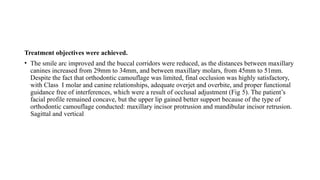 Treatment objectives were achieved.
• The smile arc improved and the buccal corridors were reduced, as the distances between maxillary
canines increased from 29mm to 34mm, and between maxillary molars, from 45mm to 51mm.
Despite the fact that orthodontic camouflage was limited, final occlusion was highly satisfactory,
with Class I molar and canine relationships, adequate overjet and overbite, and proper functional
guidance free of interferences, which were a result of occlusal adjustment (Fig 5). The patient’s
facial profile remained concave, but the upper lip gained better support because of the type of
orthodontic camouflage conducted: maxillary incisor protrusion and mandibular incisor retrusion.
Sagittal and vertical
 