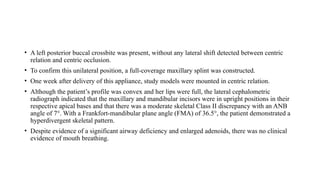• A left posterior buccal crossbite was present, without any lateral shift detected between centric
relation and centric occlusion.
• To confirm this unilateral position, a full-coverage maxillary splint was constructed.
• One week after delivery of this appliance, study models were mounted in centric relation.
• Although the patient’s profile was convex and her lips were full, the lateral cephalometric
radiograph indicated that the maxillary and mandibular incisors were in upright positions in their
respective apical bases and that there was a moderate skeletal Class II discrepancy with an ANB
angle of 7°. With a Frankfort-mandibular plane angle (FMA) of 36.5°, the patient demonstrated a
hyperdivergent skeletal pattern.
• Despite evidence of a significant airway deficiency and enlarged adenoids, there was no clinical
evidence of mouth breathing.
 