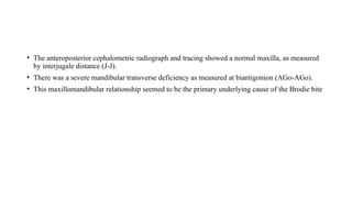 • The anteroposterior cephalometric radiograph and tracing showed a normal maxilla, as measured
by interjugale distance (J-J).
• There was a severe mandibular transverse deficiency as measured at biantigonion (AGo-AGo).
• This maxillomandibular relationship seemed to be the primary underlying cause of the Brodie bite
 