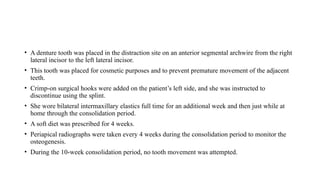 • A denture tooth was placed in the distraction site on an anterior segmental archwire from the right
lateral incisor to the left lateral incisor.
• This tooth was placed for cosmetic purposes and to prevent premature movement of the adjacent
teeth.
• Crimp-on surgical hooks were added on the patient’s left side, and she was instructed to
discontinue using the splint.
• She wore bilateral intermaxillary elastics full time for an additional week and then just while at
home through the consolidation period.
• A soft diet was prescribed for 4 weeks.
• Periapical radiographs were taken every 4 weeks during the consolidation period to monitor the
osteogenesis.
• During the 10-week consolidation period, no tooth movement was attempted.
 