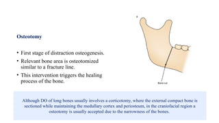 Osteotomy
• First stage of distraction osteogenesis.
• Relevant bone area is osteotomized
similar to a fracture line.
• This intervention triggers the healing
process of the bone.
Although DO of long bones usually involves a corticotomy, where the external compact bone is
sectioned while maintaining the medullary cortex and periosteum, in the craniofacial region a
osteotomy is usually accepted due to the narrowness of the bones.
 