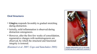 Oral Structures
• Gingiva responds favorably to gradual stretching
during distraction.
• Initially, mild inflammation is observed during
distraction osteogenesis.
• However, after the first few weeks of consolidation,
regenerative changes with neohistiogenesis are
observed, by which the structural and functional
integrity is restored.
(Kunimori et al. 2007; Cope and Samchukov 2005)
 