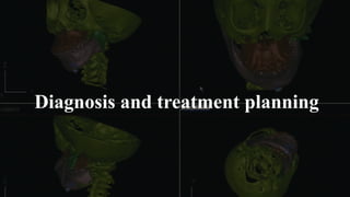 Diagnosis and treatment planning
 