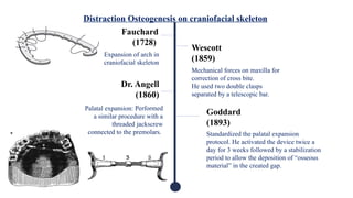 Distraction Osteogenesis on craniofacial skeleton
Fauchard
(1728)
Expansion of arch in
craniofacial skeleton
Wescott
(1859)
Mechanical forces on maxilla for
correction of cross bite.
He used two double clasps
separated by a telescopic bar.
Dr. Angell
(1860)
Palatal expansion: Performed
a similar procedure with a
threaded jackscrew
connected to the premolars.
Goddard
(1893)
Standardized the palatal expansion
protocol. He activated the device twice a
day for 3 weeks followed by a stabilization
period to allow the deposition of “osseous
material” in the created gap.
 