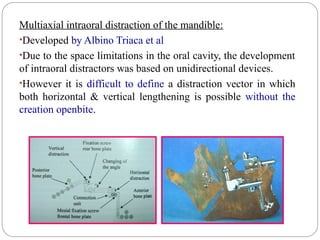 Distractor Definition Distraction Osteogenesis in orthodontics | PPT